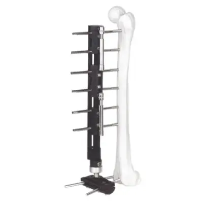 External Fixator Systems