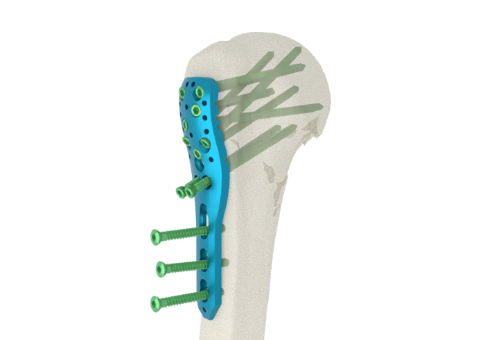 <span>Innovation</span> <br> built to <span>heal</span>