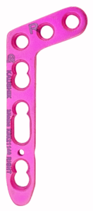 2.4 mm Dorsal Oblique L-Shaped Distal Radius Locking Plate (3 Holes in Head), Left/Right