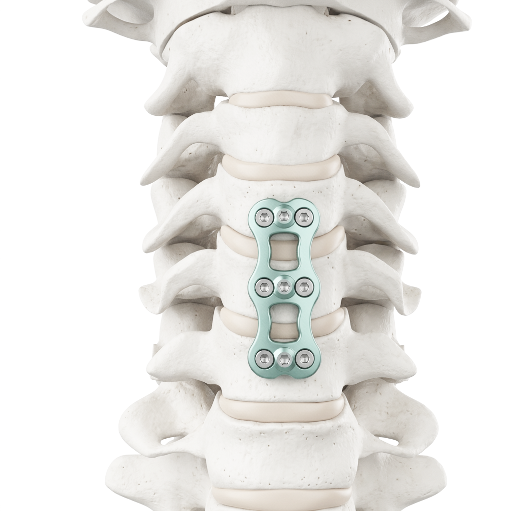 Conventional Spinal System