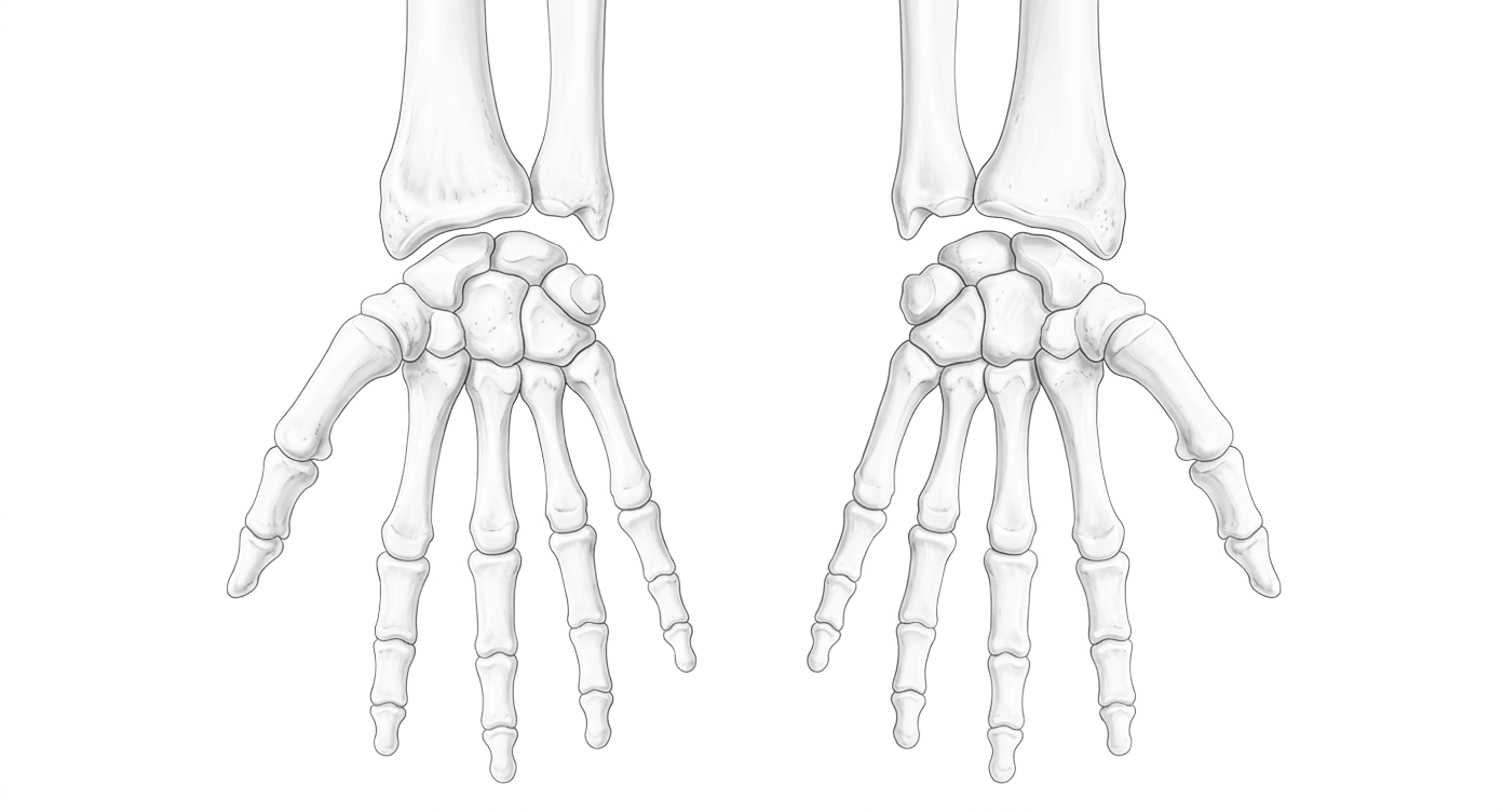 Distal Radius and Ulna/Hand