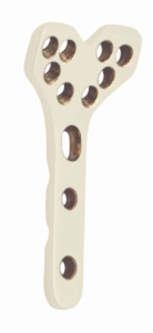 2.4 mm Volar Column Distal Radius Locking Plate – 8 Holes in Head (Left/Right)