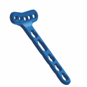 2.4 mm Volar Distal Radius Locking Plate – Extra-Articular (5 Holes in Head, Left/Right)